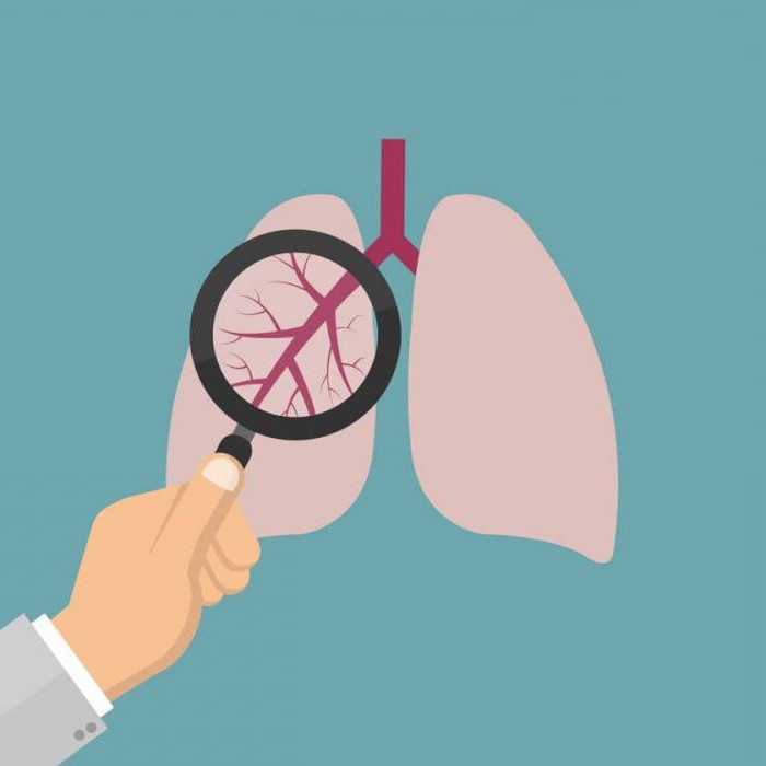 臨床的推奨間質性肺疾患 